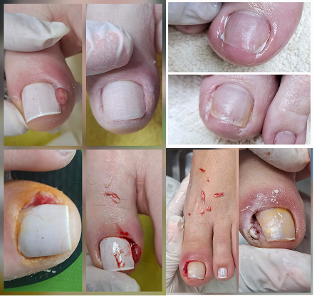 Imagem ilustrativa de pés